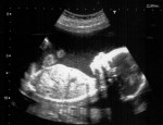 fetus ultrasound 1